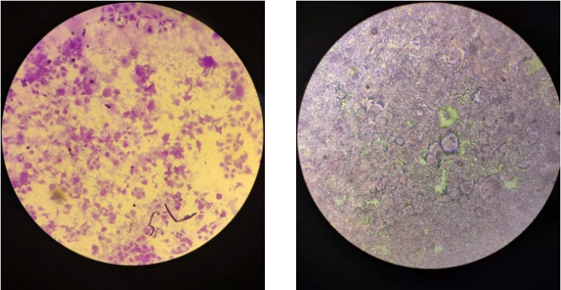 ​​Micrografías de células HaCaT cultivadas sobre un substrato sin estructuras de carbono (izquierda) y  sobre un substrato con e